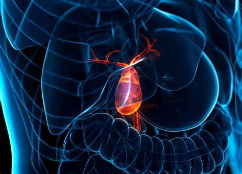 Life after cholecystectomy