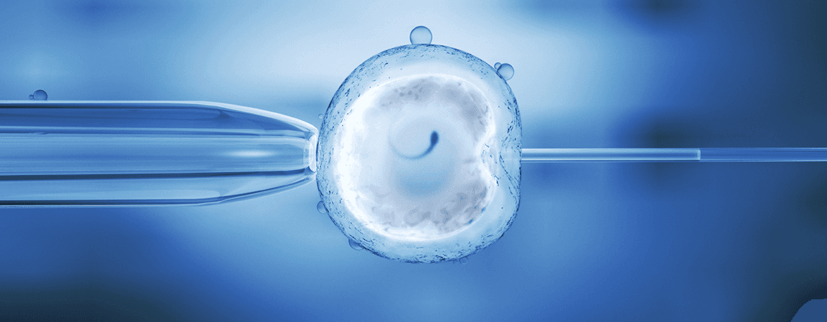 In Vitro Fertilization (IVF)