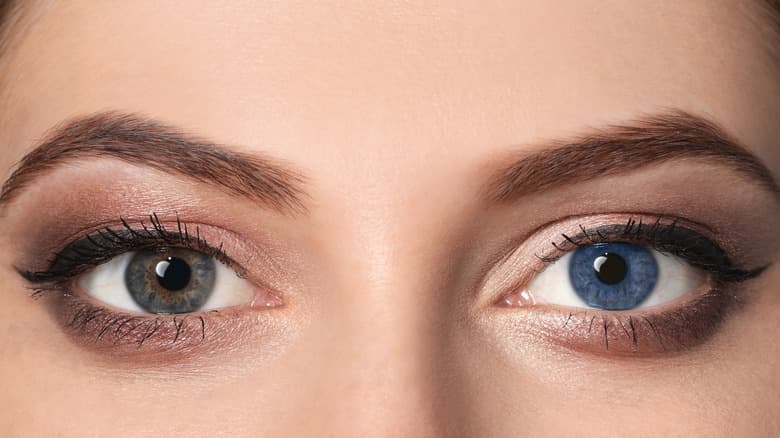 Eye Color Change Surgery cost in Iran