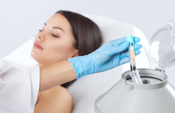 PRP injection cost in Iran