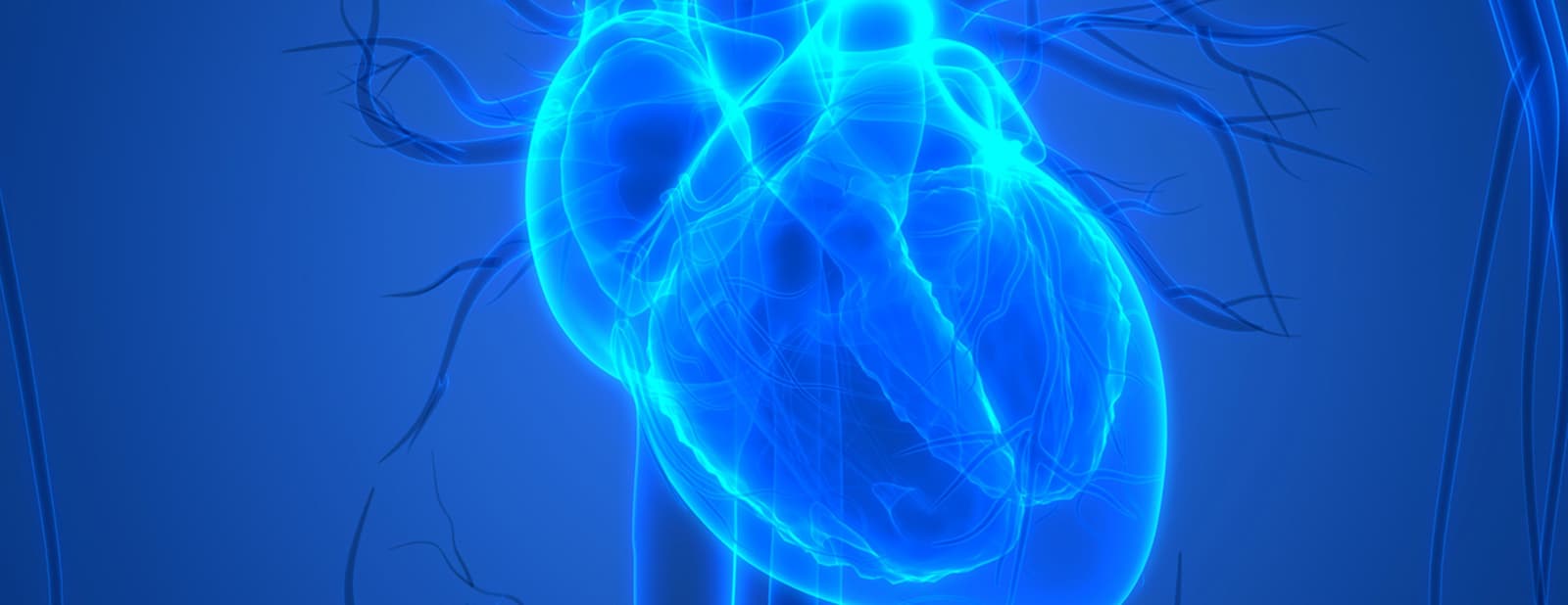 Angiography