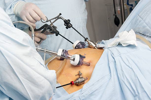 What is the role of diet in gastric bypass?