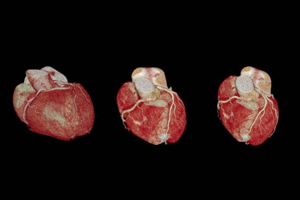 What are Congenital heart defects?