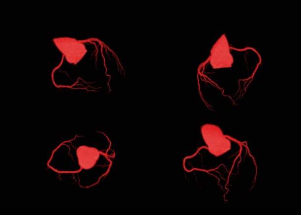 Types of Congenital heart defects