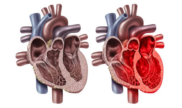 Congenital heart defect repair risks