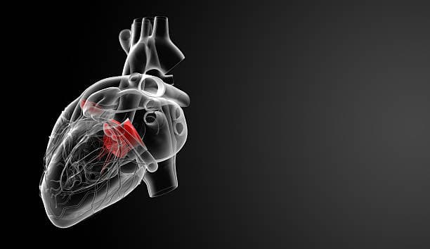 Congenital heart defect repair cost in Iran