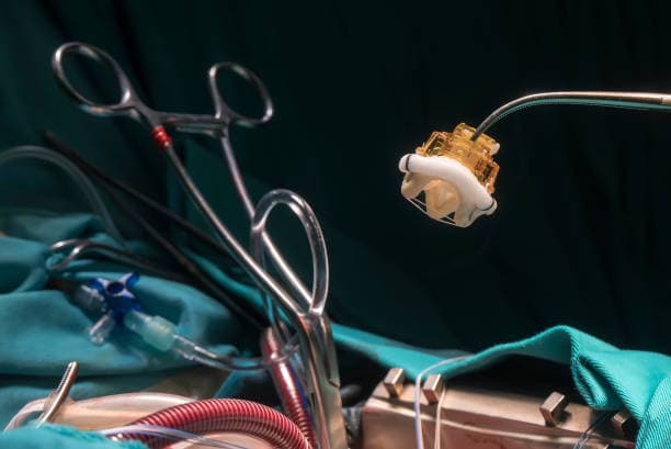 Valve Repair 