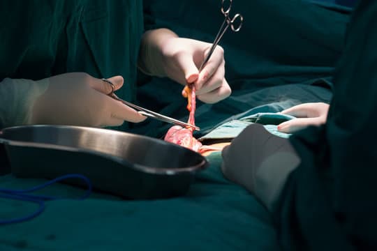 Who needs an Appendectomy?
