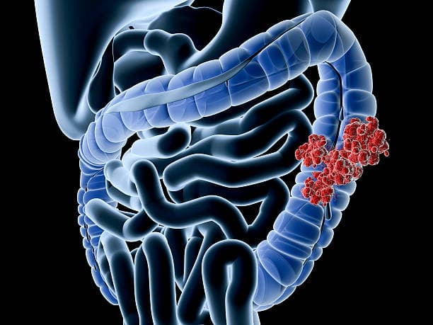 What is the Colon?