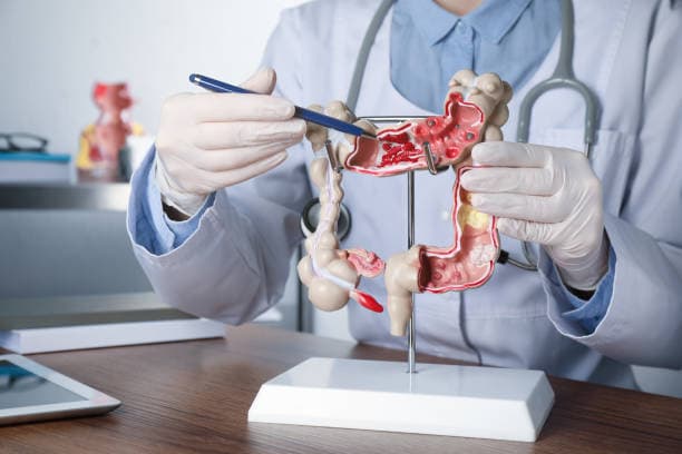 What does Colectomy treat?