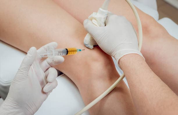 PRP Therapy Risks and Side Effects