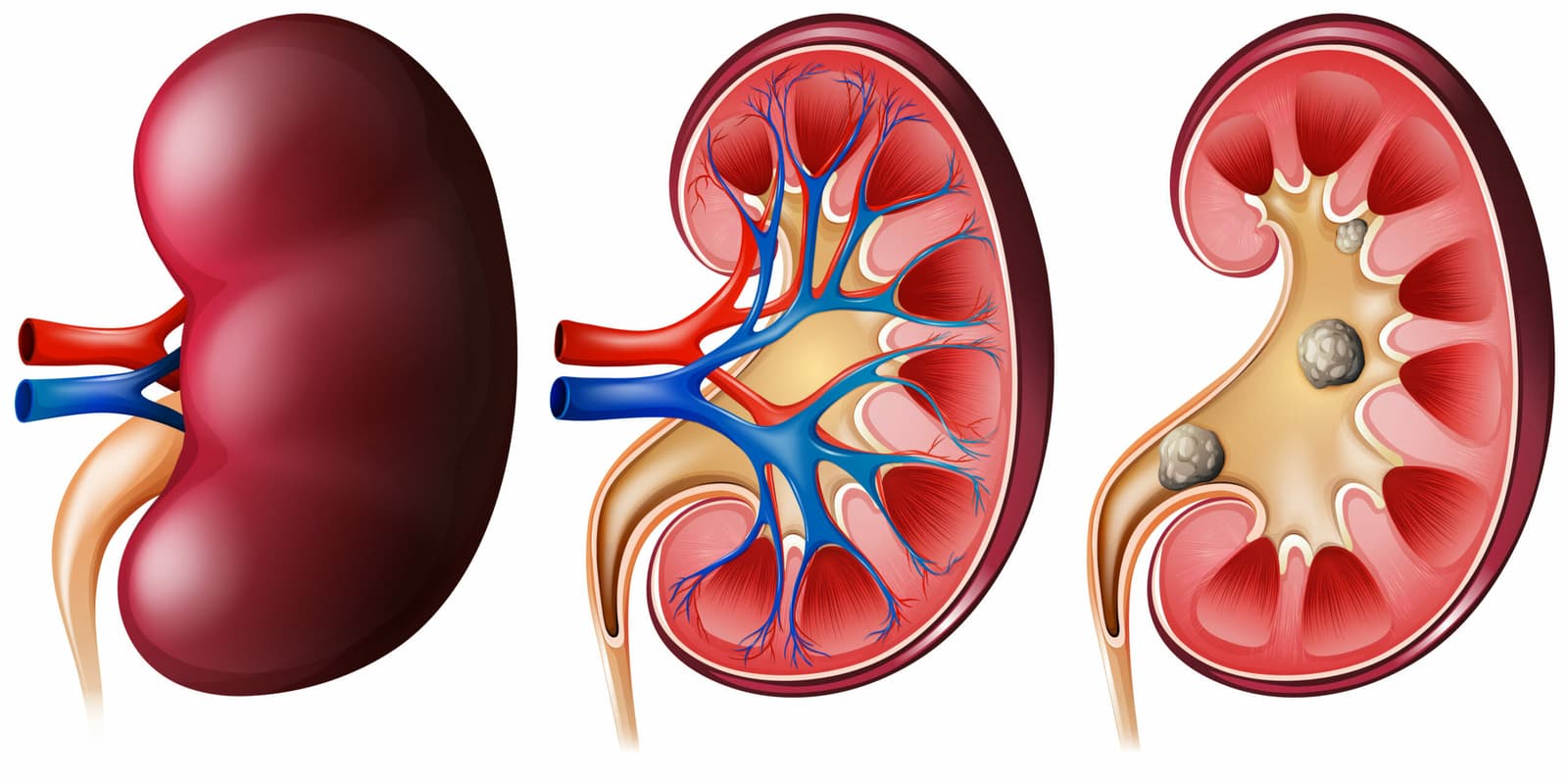 How to prepare for Splenectomy?