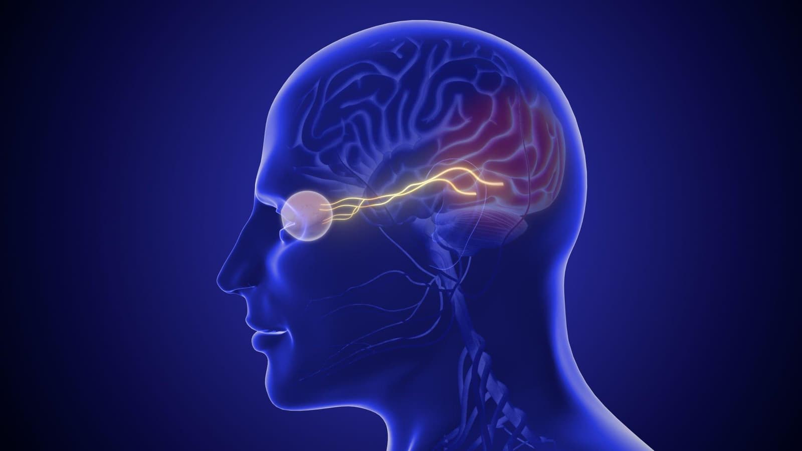 Neuro-ophthalmology recovery
