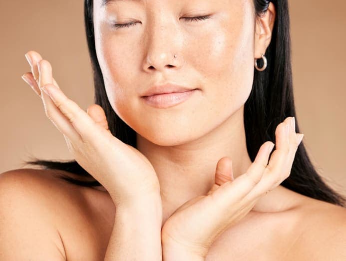 What is melasma?