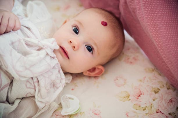 What are the types of hemangiomas?