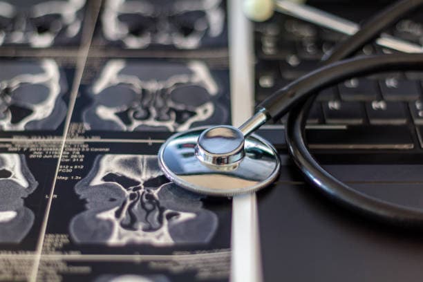 What is sinus surgery?
