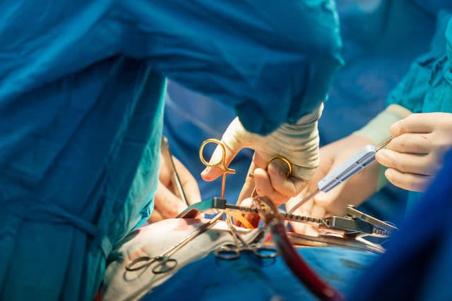 Who needs Arrhythmia Surgery?