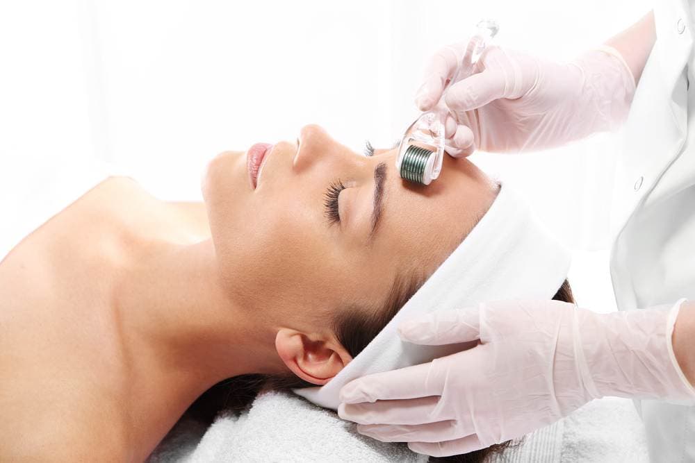 What happens after microneedling?