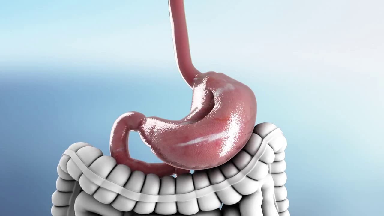What does each types of Gastrectomy treat?