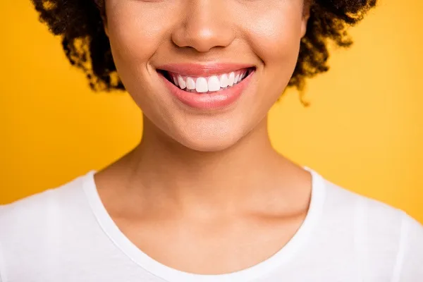 Dental Composite cost in Iran 
