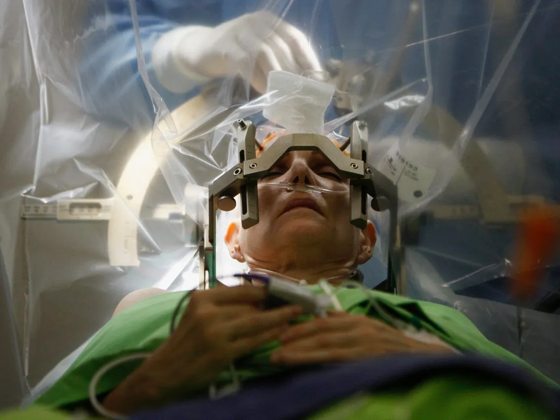 Cost of general brain surgery in Iran