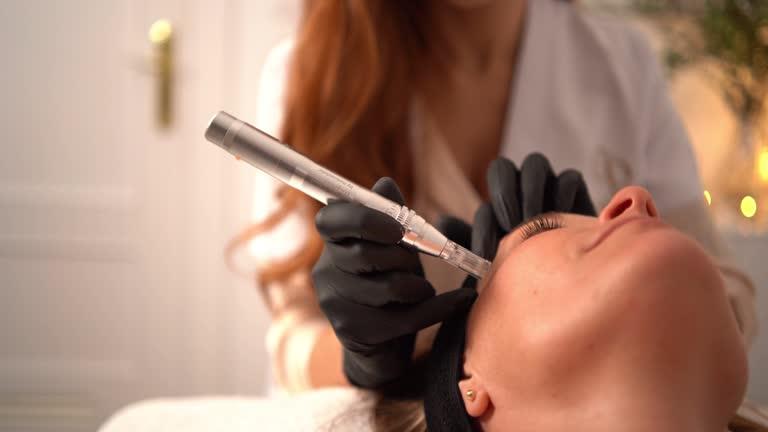 How long does microneedling take to heal?