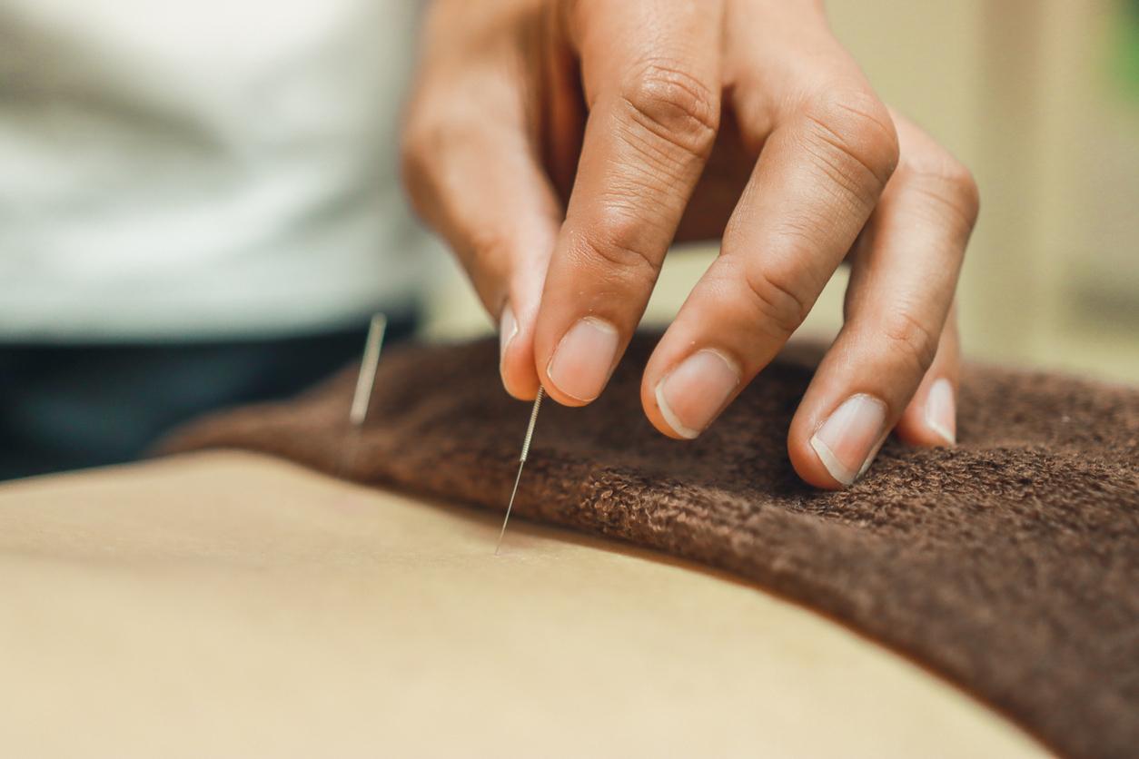 How does acupuncture affect the body?