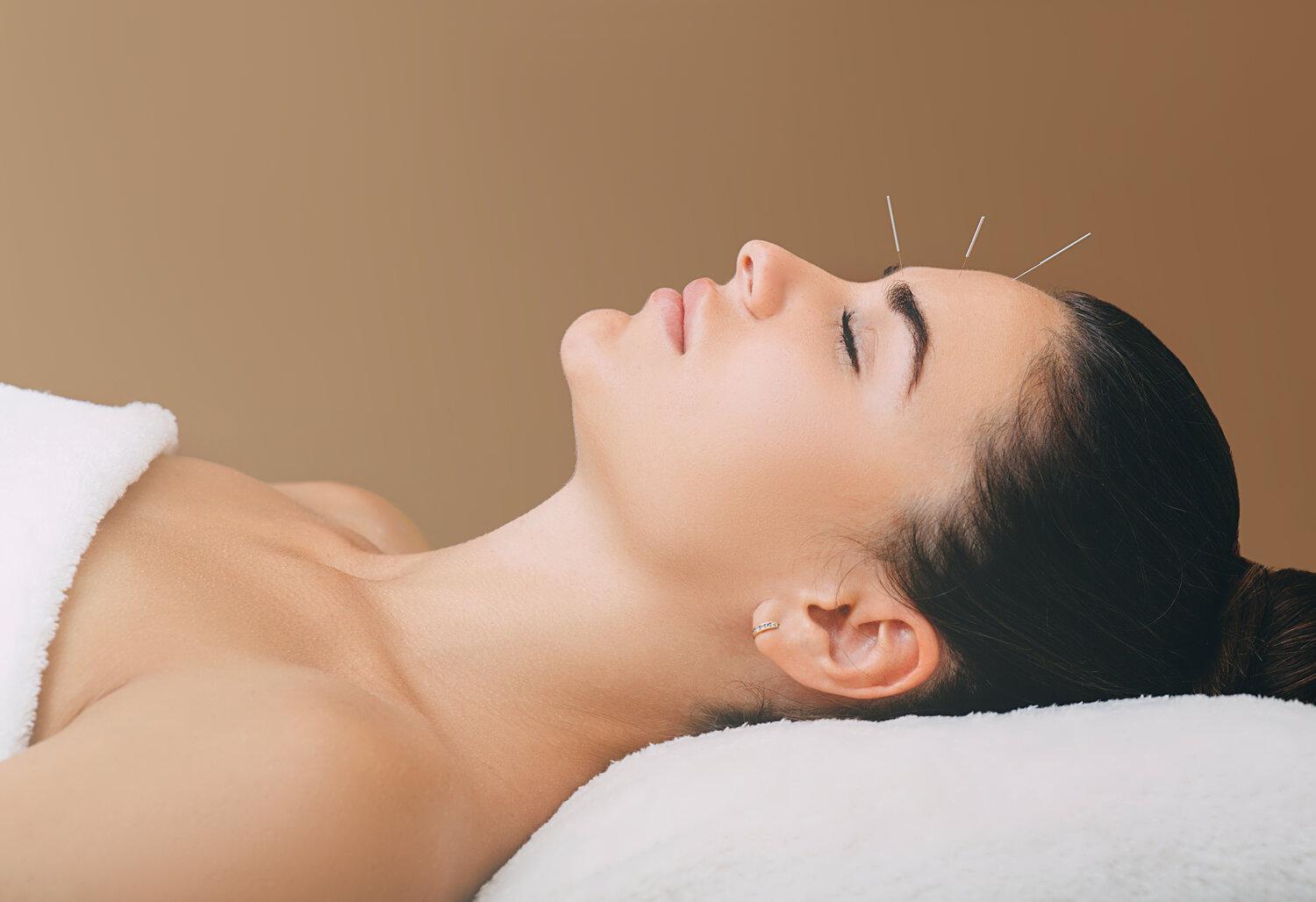 What conditions may be helped by acupuncture?