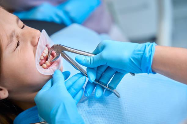 Tooth Extraction Aftercare