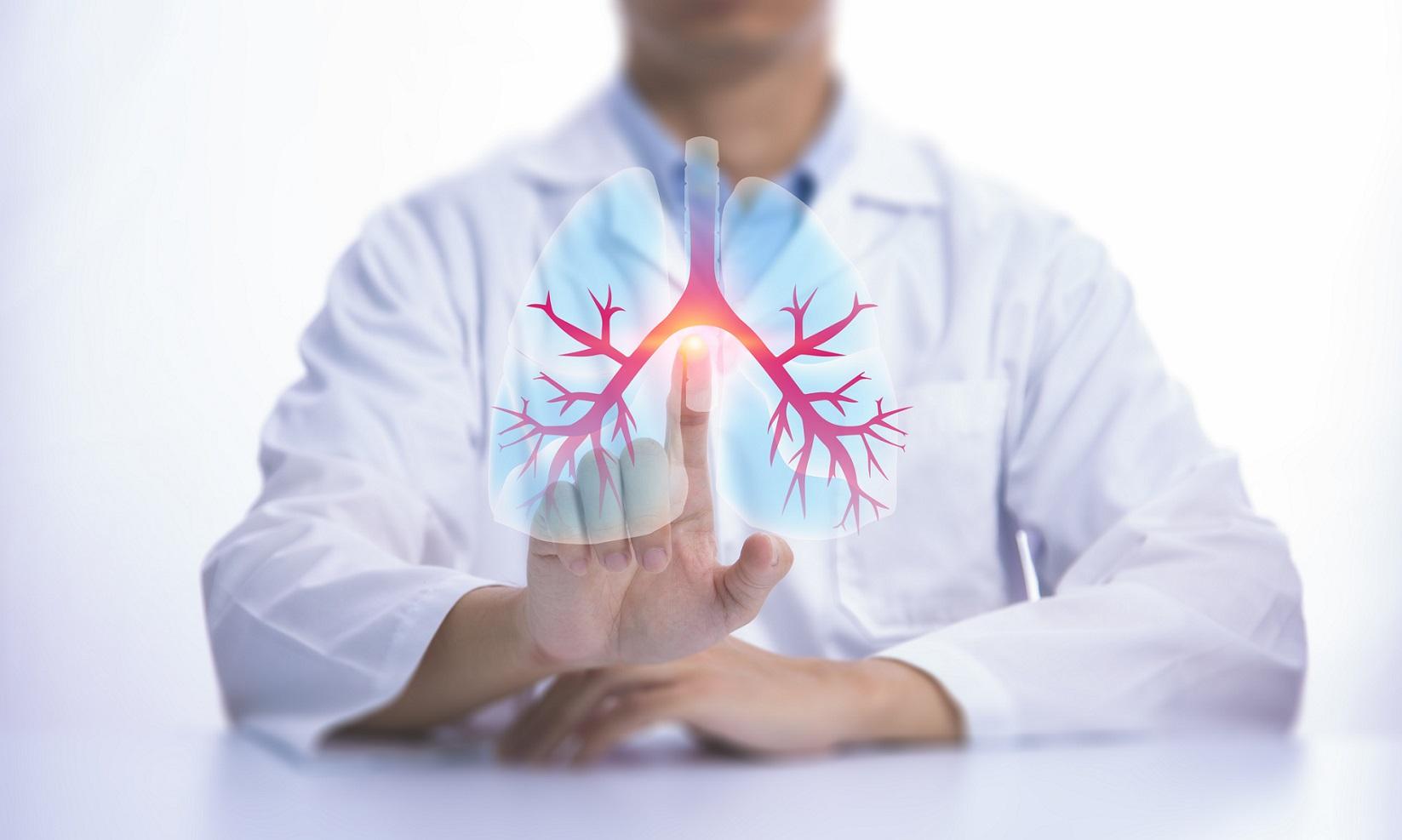 What is chronic bronchitis?       