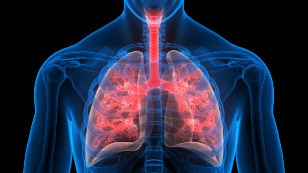 Acute vs. chronic bronchitis