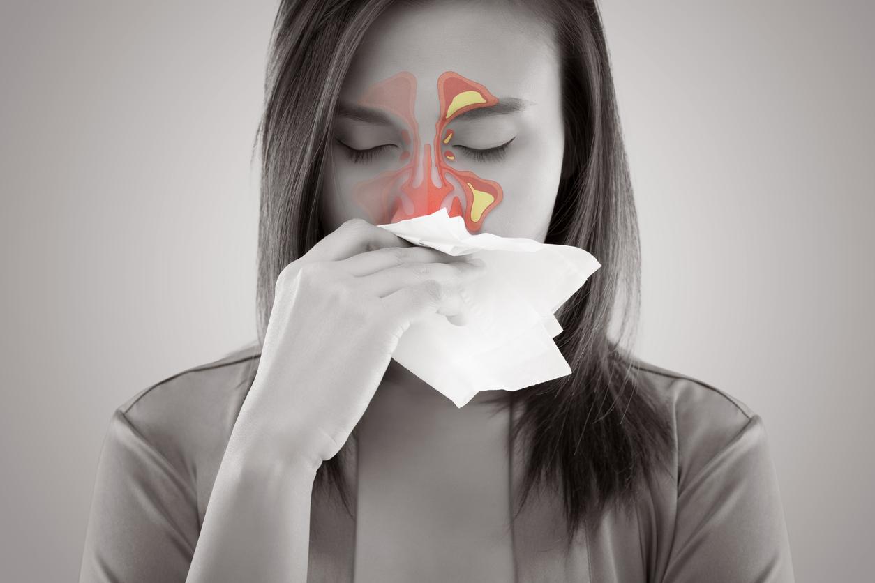 Sinusitis Treatment 