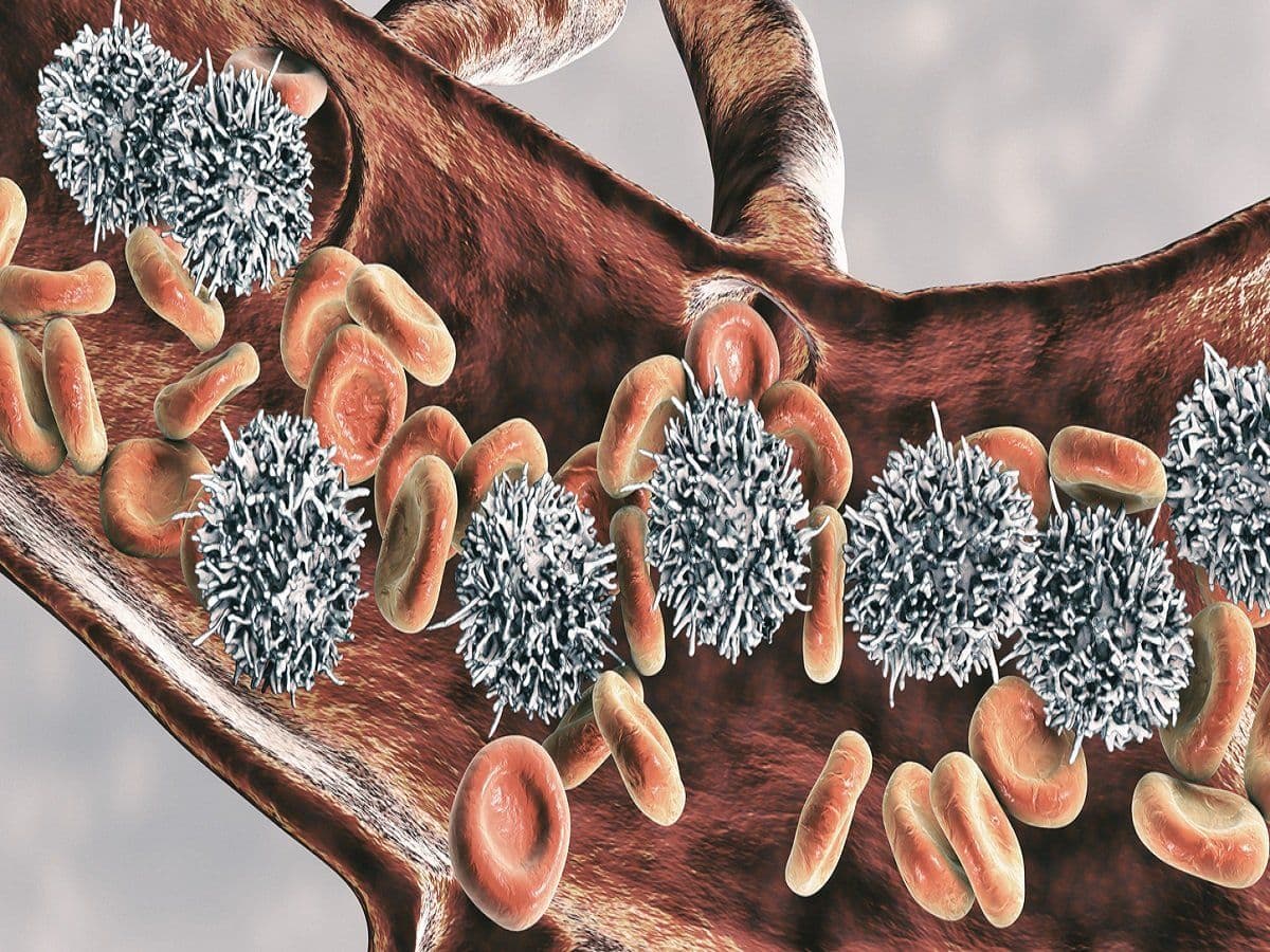 Types of bone marrow and stem cell transplants