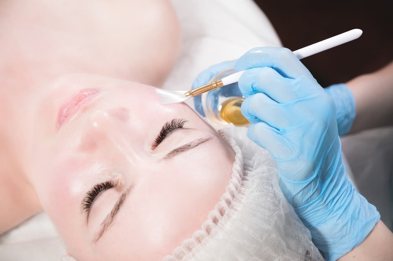 Aftercare & results of a chemical peel