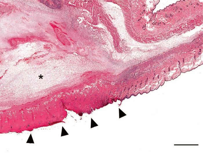 What causes coagulative necrosis?