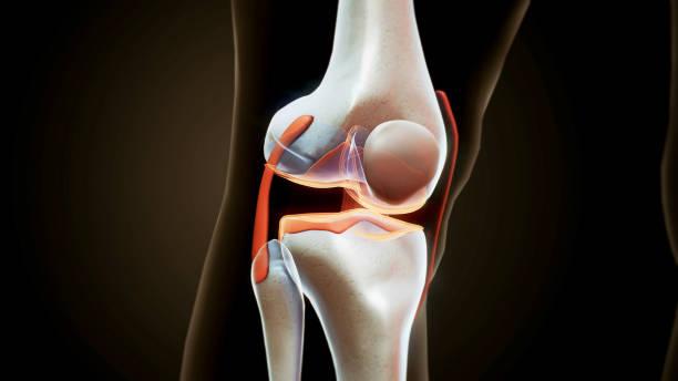 Joint replacement risks benefits
