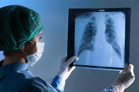 Lobectomy recovery process