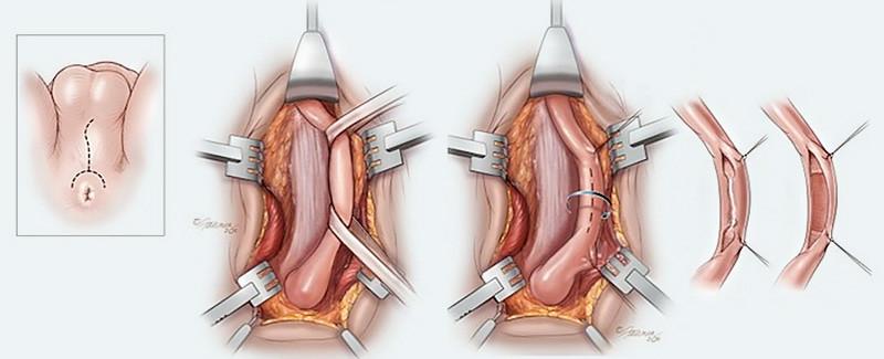 What is the urethra?