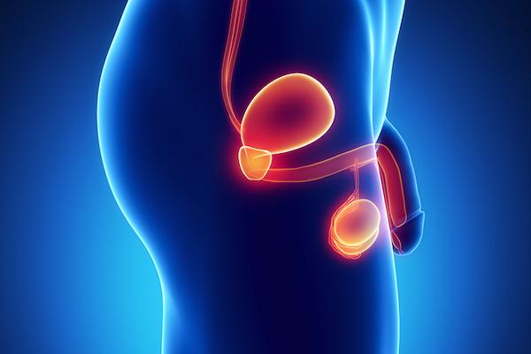 Urethroplasty Recovery