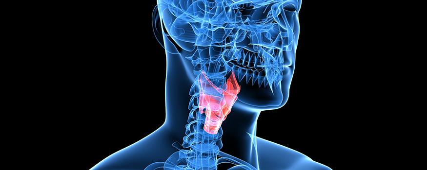 Laryngectomy