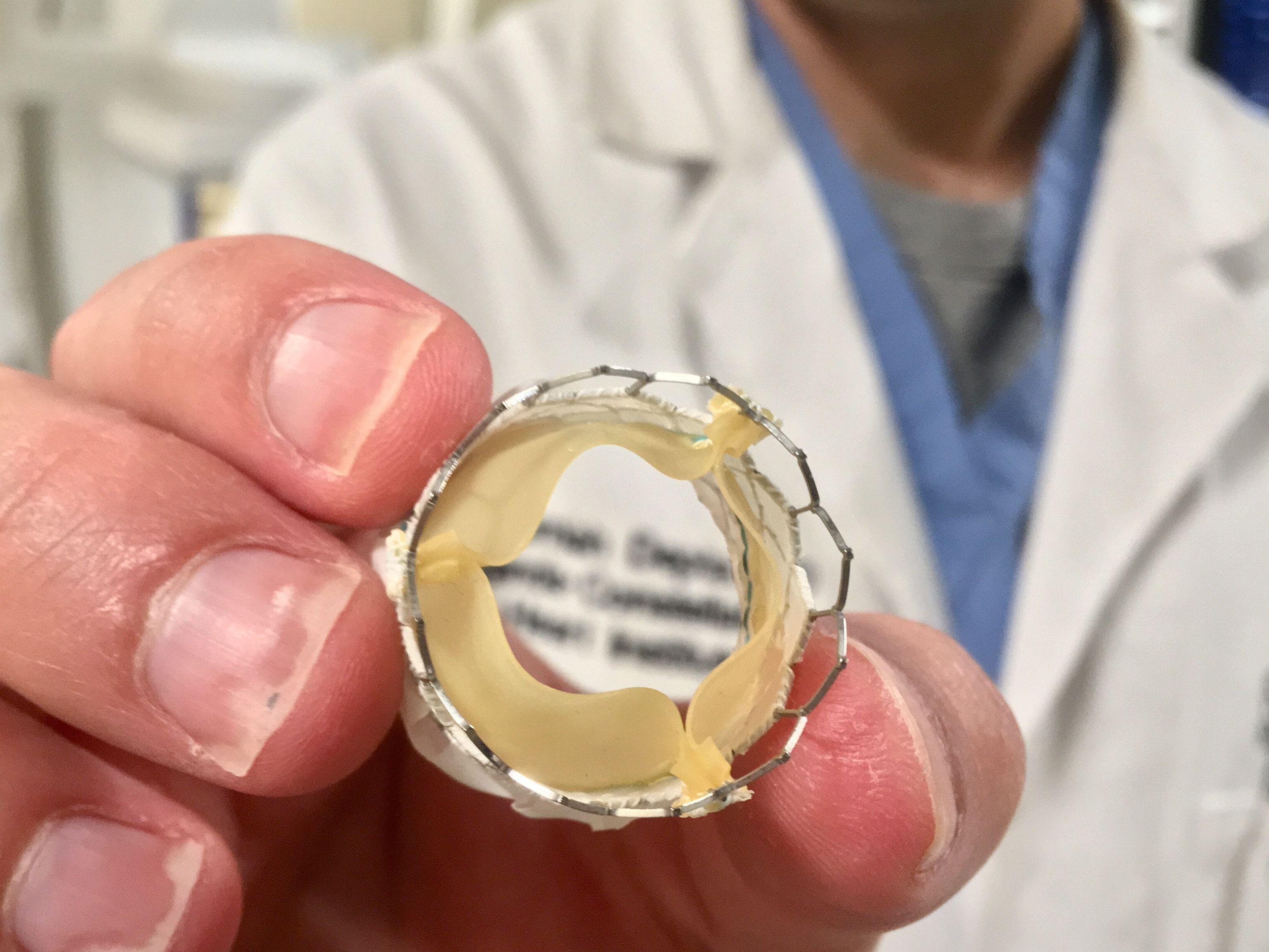 Aortic valve surgery benefits