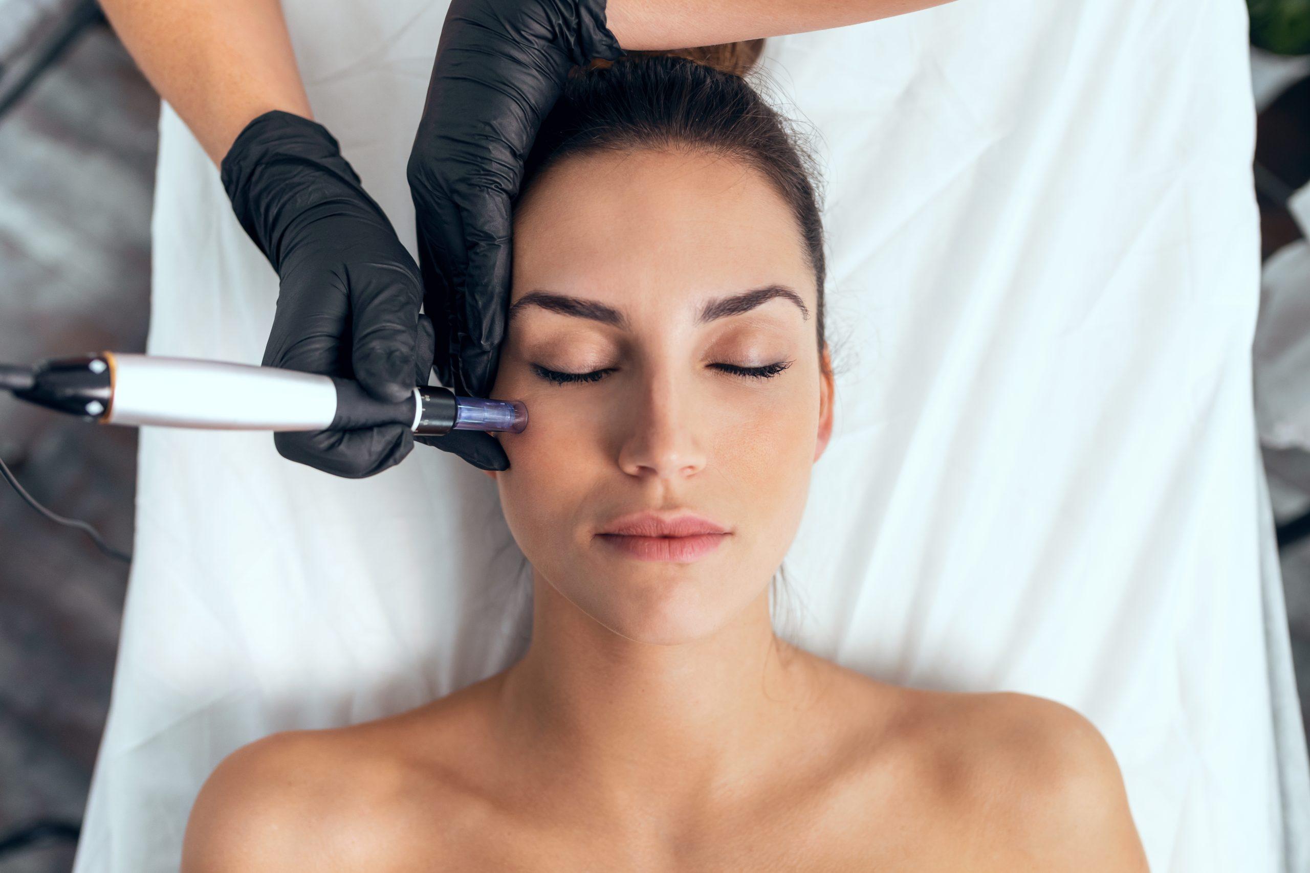 Microneedling cost in Iran