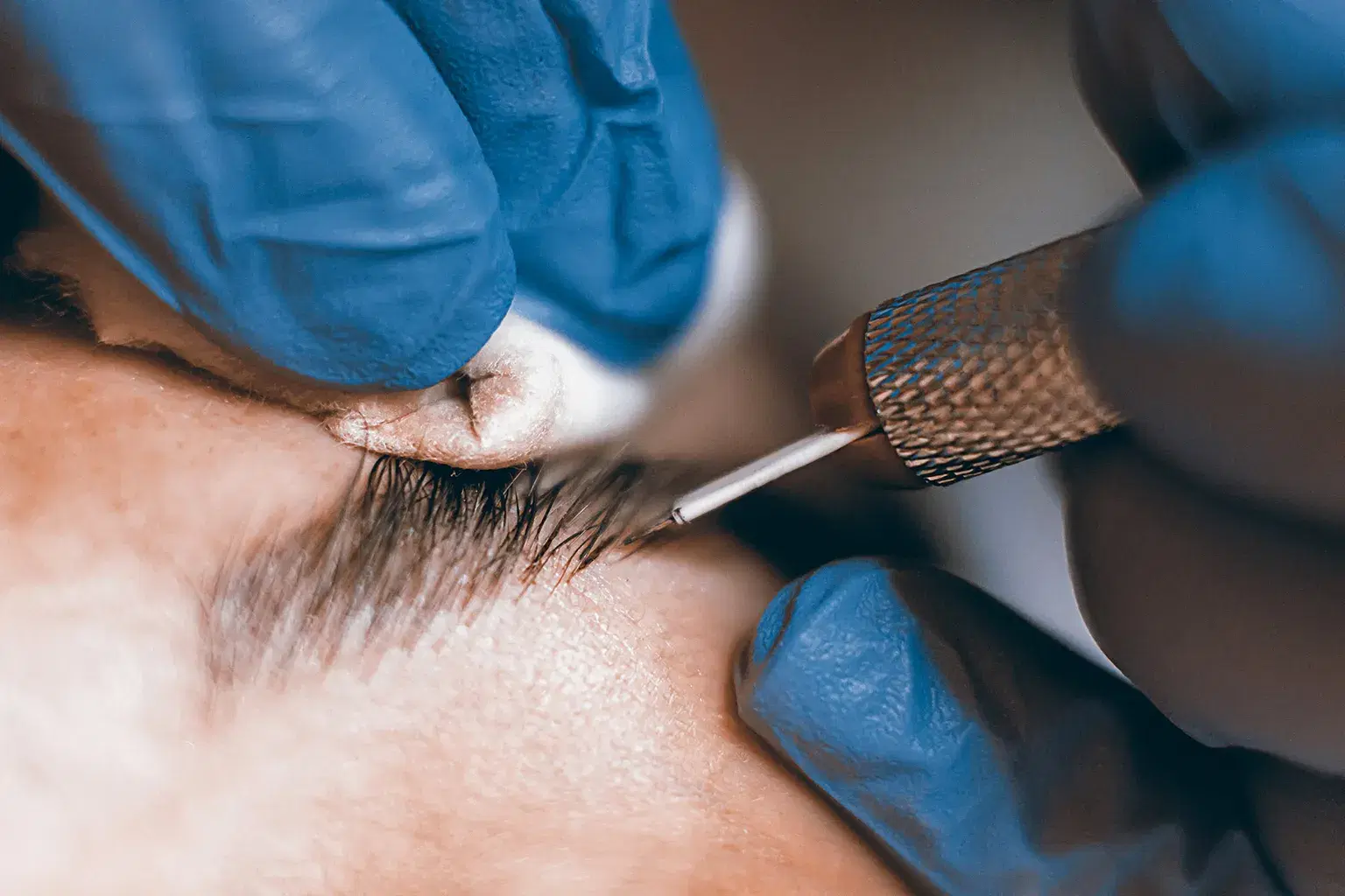 Who can get Microblading?