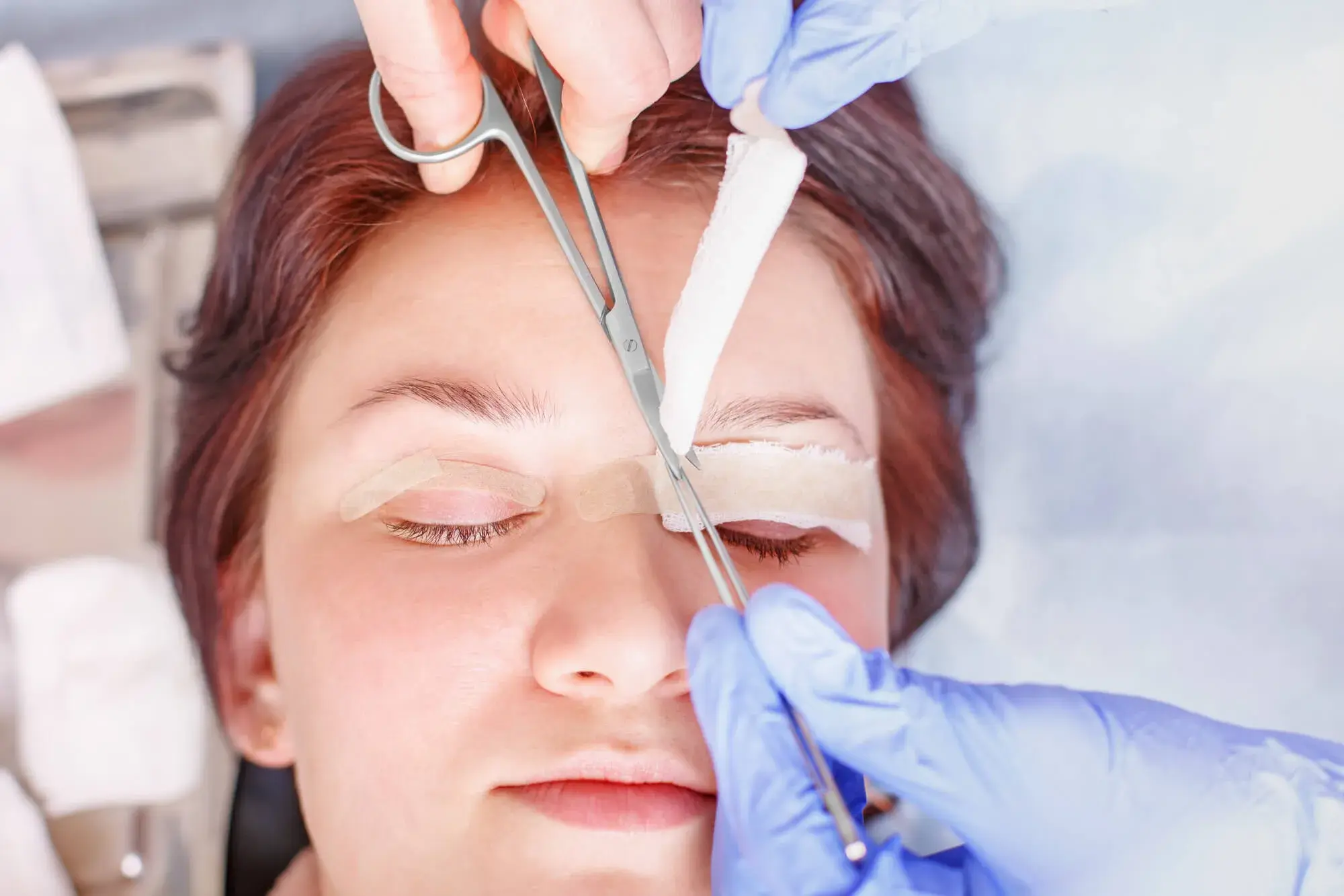 Cosmetic upper-eyelid Blepharoplasty