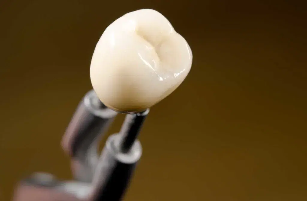 Advantages of Dental Crown in Iran