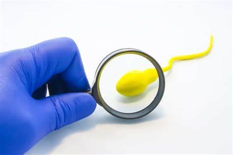 Vasectomy Process in Iran