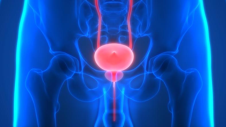 Enlarged Prostate Gland Treatment Process in Iran