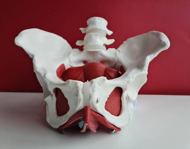 Who needs Pelvic Floor Reconstruction?