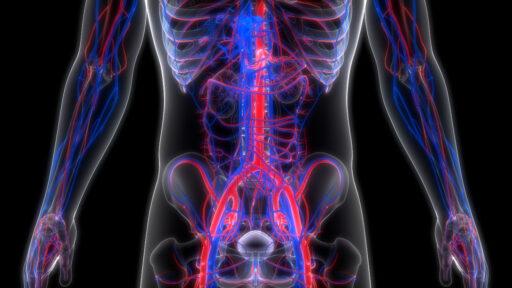 Angiography cost in Iran