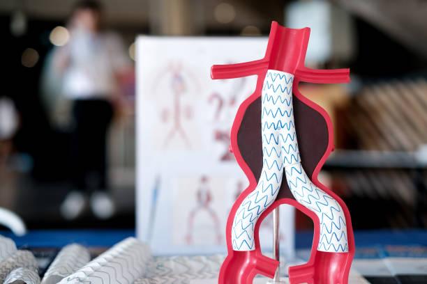 How is Aortic Surgery done?